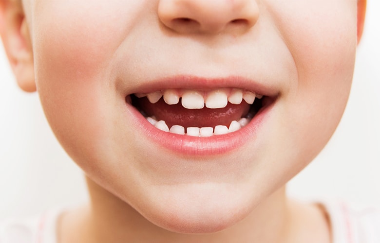 Τρεις λόγοι για να επιλέξεις μια ηλεκτρική οδοντόβουρτσα για το παιδί